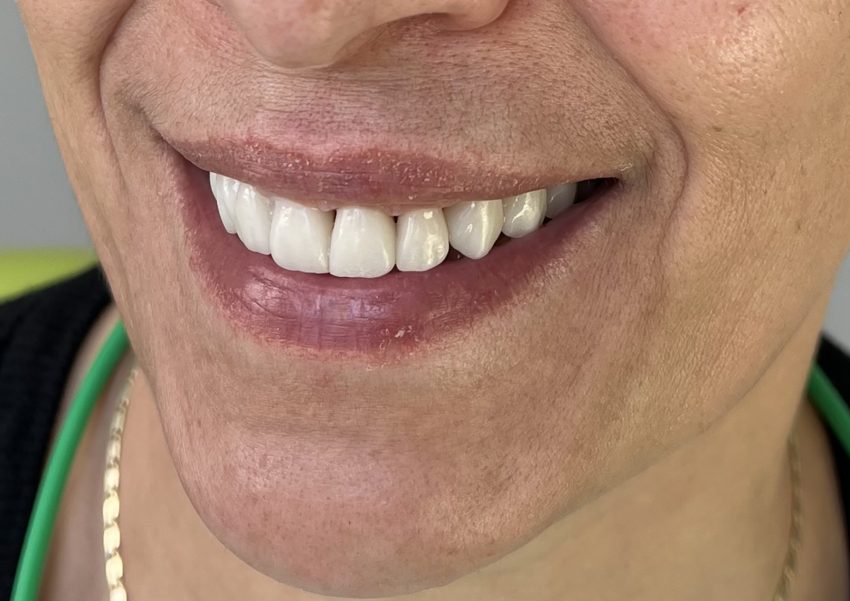 Zile cu zâmbet perfect la clinica stomatologică Smile Central